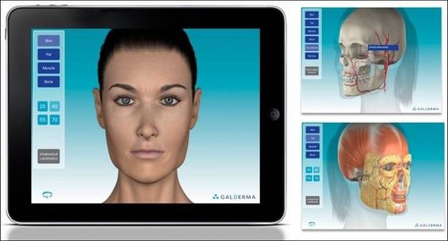 Views from the Galderma iPad app